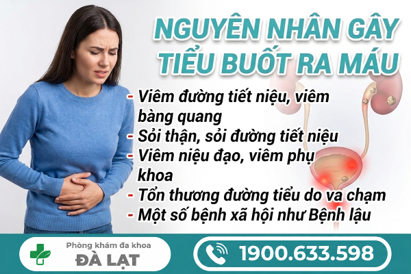 Hình ảnh minh họa